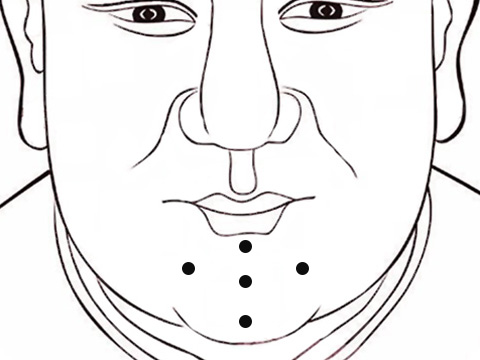 查运势痣相之脸上的痣图解：男人下巴有痣代表什么(图1)