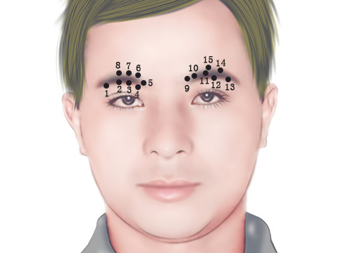 查运势痣相之眉毛有痣：眉毛痣的位置与命运图解(图2)
